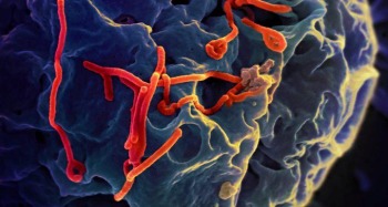 Scanning electron micrograph of Ebola virus budding from the surface of a Vero cell.